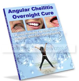 Angular Cheilitis Overnight Cure